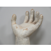 Arm